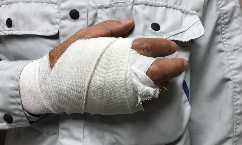 Photo of an Injured Worker